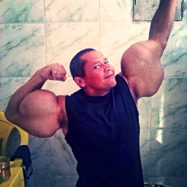 synthol_10
