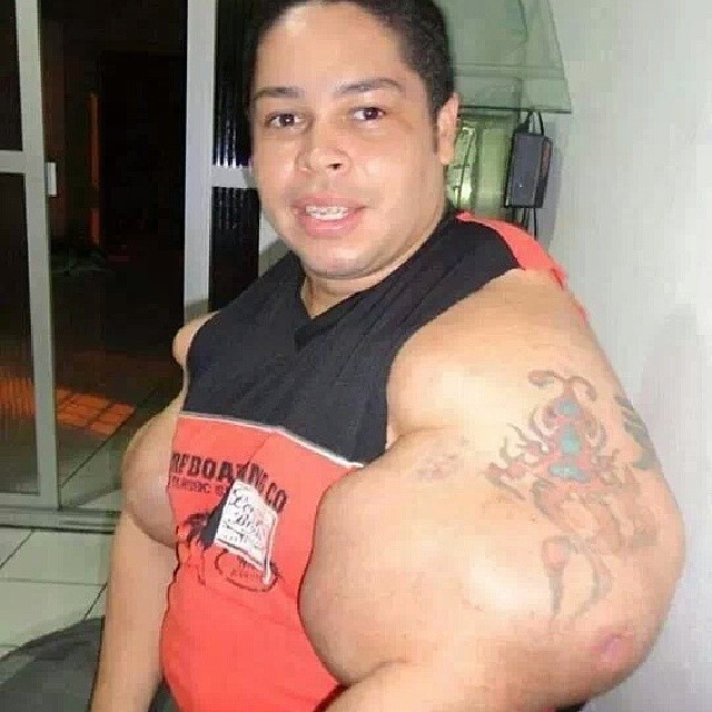 synthol_12