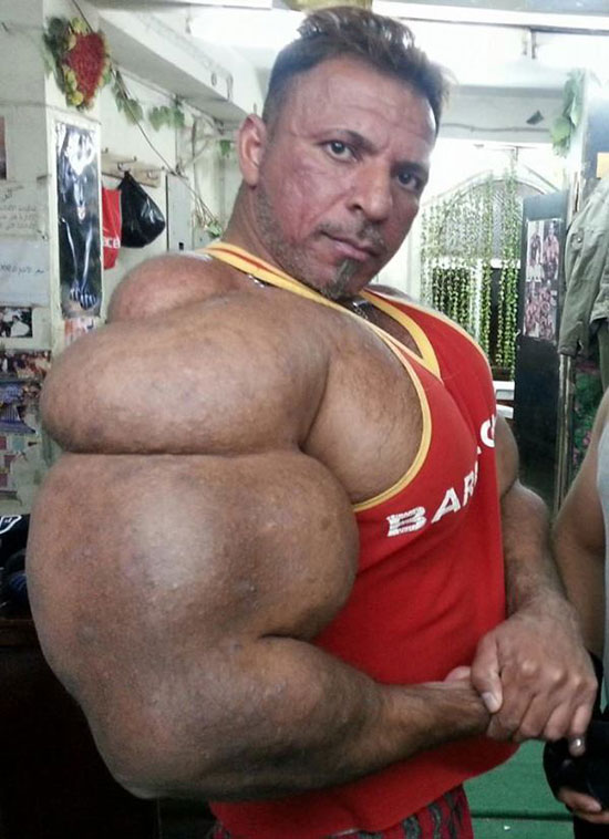 synthol_20