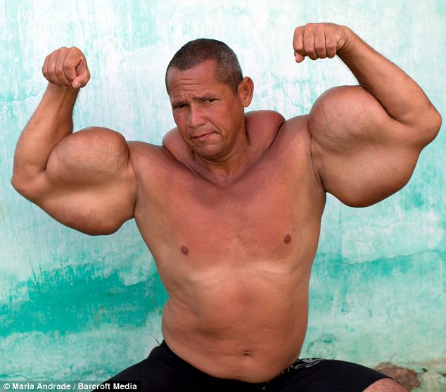 synthol_25