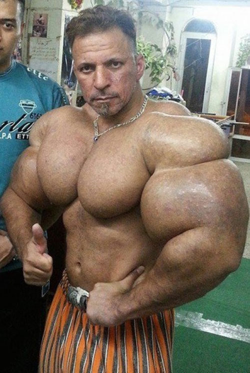synthol_26