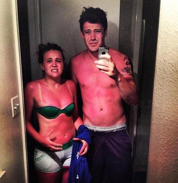 a-friendly-and-painful-reminder-to-wear-sunscreen-this-weekend-27-photos-13