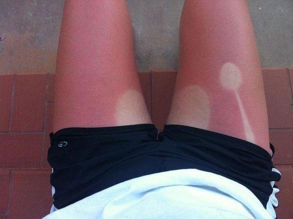 a-friendly-and-painful-reminder-to-wear-sunscreen-this-weekend-27-photos-15